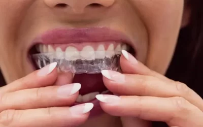 Invisalign Colorado Springs: Clear Aligner Therapy for Discreet Orthodontic Correction